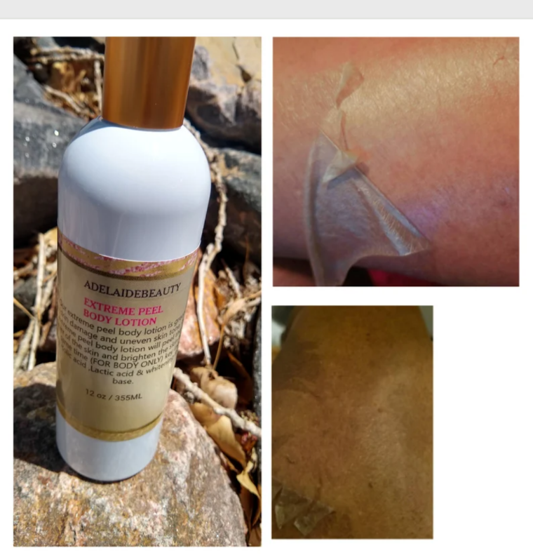 40 % EXTREME PEEL BODY LOTION /8 oz
