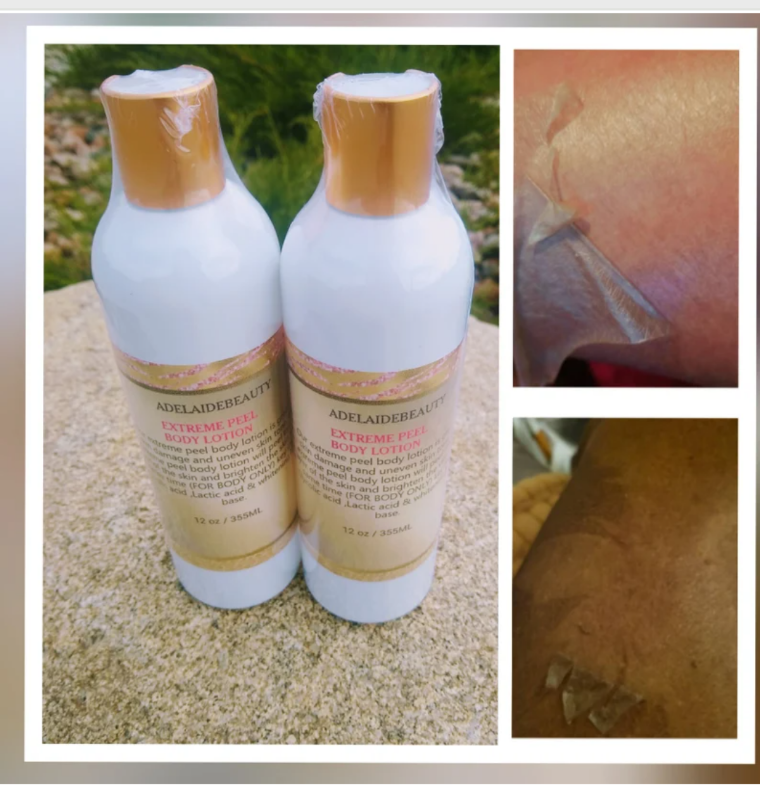 40 % EXTREME PEEL BODY LOTION /8 oz