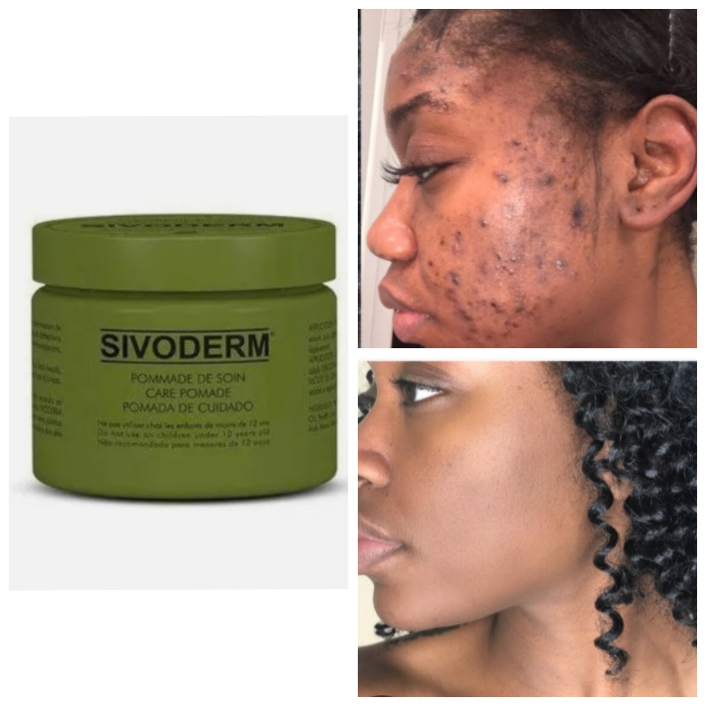 Sivoderm cream/ dark cream corrector