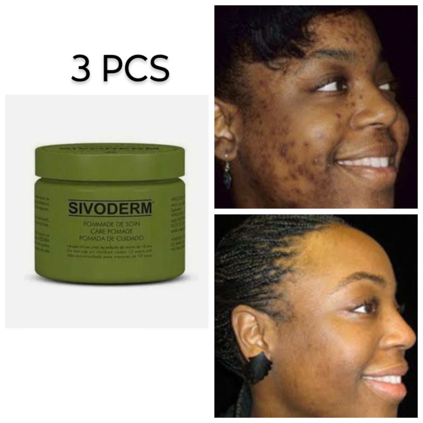 Sivoderm cream/ dark cream corrector