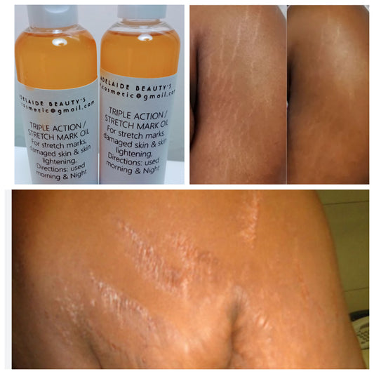 TRIPLE ACTION STRETCH MARK OIL