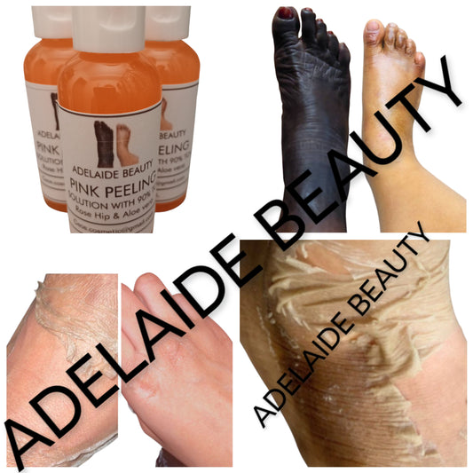 PINK PEELING SOLUTION WITH 90%TCA
