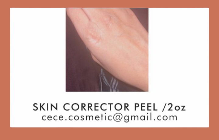 SKIN CORRECTOR ACID PEEL/ 2 OZ