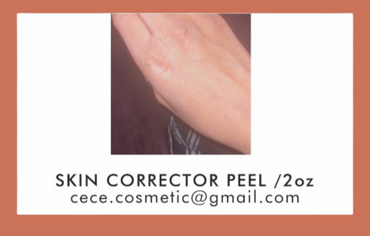 SKIN CORRECTOR ACID PEEL/ 2 OZ