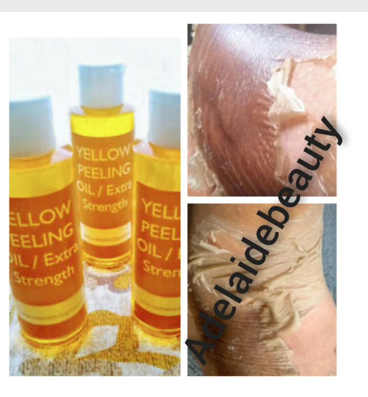 Yellow peeling oil extra strength / New Improvement