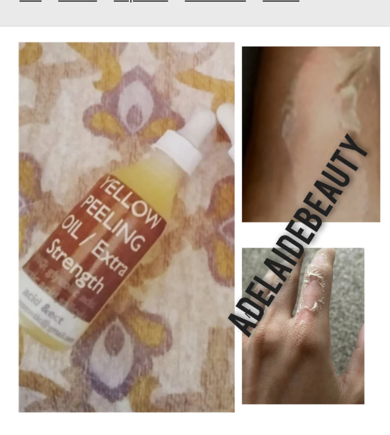 YELLOW PEELING OIL / EXTRA STRENG/ NEW IMPROVEMENT TH