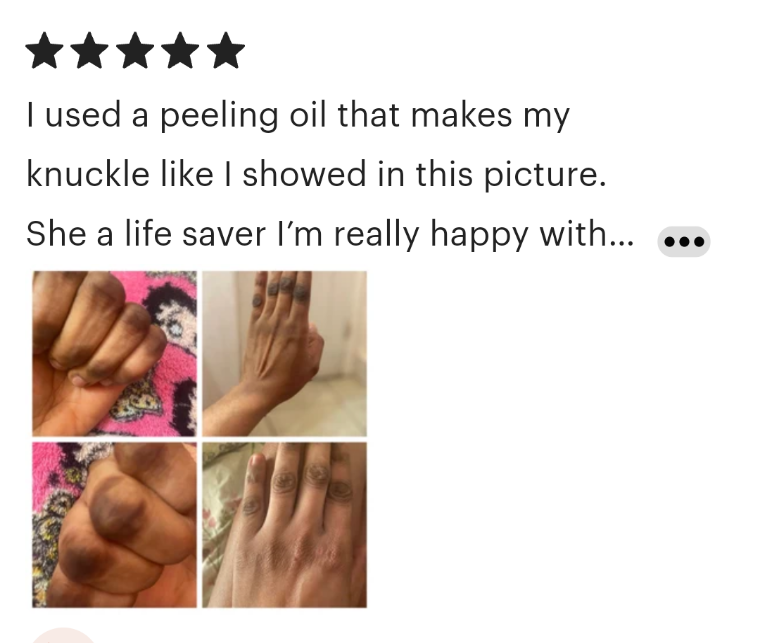 YELLOW PEELING OIL / EXTRA STRENG/ NEW IMPROVEMENT TH